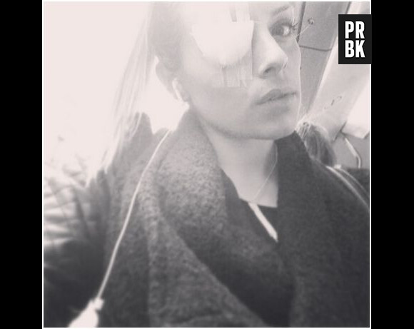 Alexia Mori : selfie avec un pansement à l'oeil, le 28 février 2014 sur Instagram