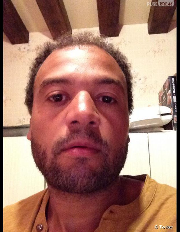 Fabrice Eboué obligé de changer de coupe de cheveux... à cause du