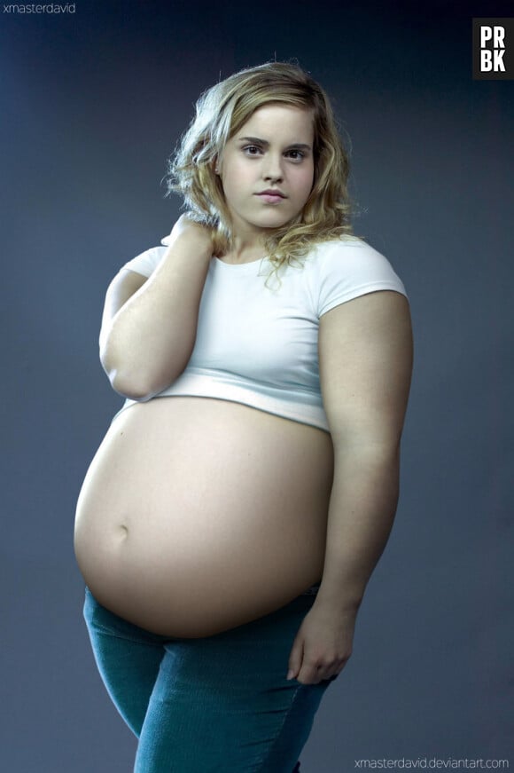 Emma Watson métamorphosée en obèse via Photoshop par l'artiste David Lopera