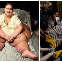 Cette femme pesait 500 kilos, elle en a perdu près de 400, aujourd&#039;hui, elle est méconnaissable !