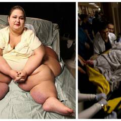 Cette femme pesait 500 kilos, elle en a perdu près de 400, aujourd'hui, elle est méconnaissable !