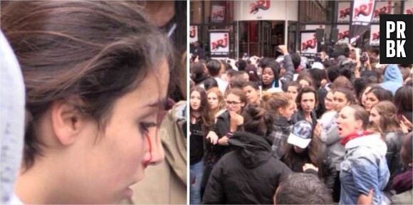 Justin Bieber : après une bagarre, une fan finit le nez en sang à Paris, le 16 septembre 2015