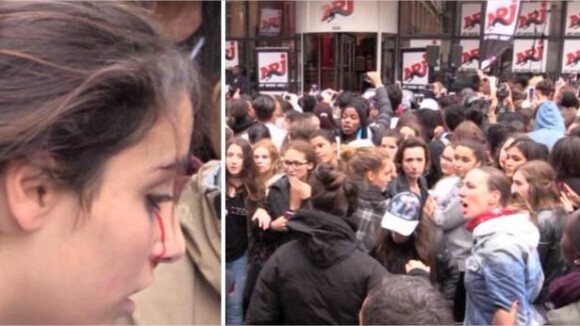 Justin Bieber : après une bagarre, une fan finit le nez en sang à Paris !