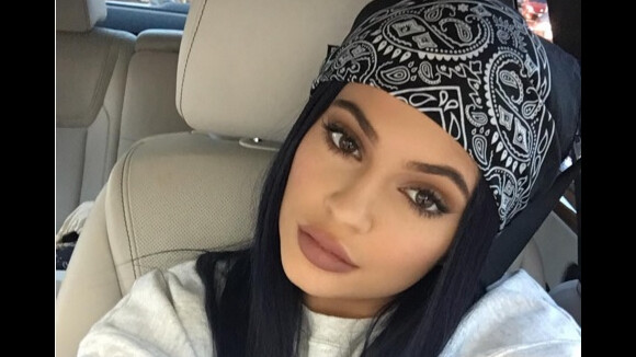 Kylie Jenner et ses lèvres pulpeuses : son explication étonnante sur Snapchat