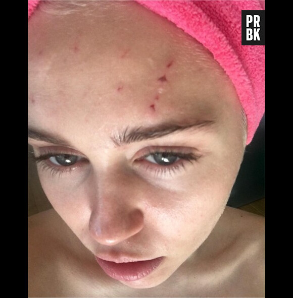 Miley Cyrus blessée à cause d'un chat sur Instagram le 4 avril 2016
