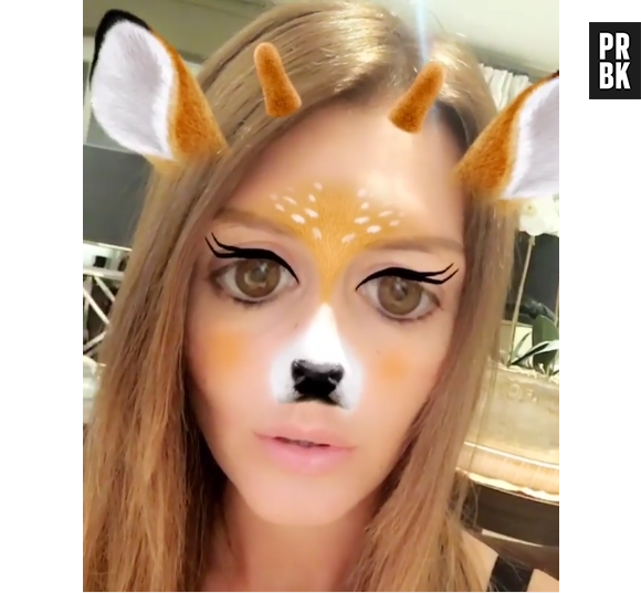 Amélie Neten a-t-elle eu recours à la chirurgie pour refaire ses pommettes ? Elle répond