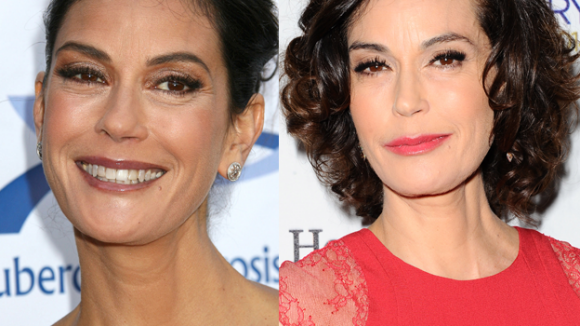 Teri Hatcher métamorphosée par le botox ? Les photos avant/après qui font peur
