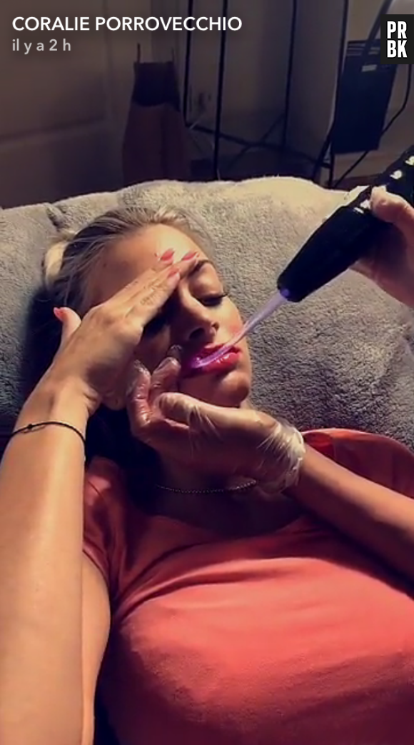 Mélanie Da Cruz dévoile ses nouvelles lèvres pulpeuses sur Snapchat