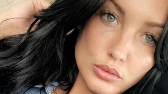 Aurélie Dotremont cède encore à la chirurgie esthétique : cette fois, place au visage