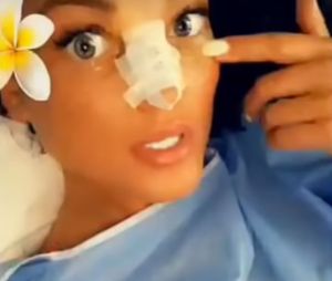 Aurélie Dotremont a encore cédé à la chirurgie esthétique : elle a fait refaire son nez.