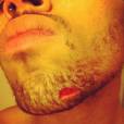 Chris Brown agressé par la team de Drake