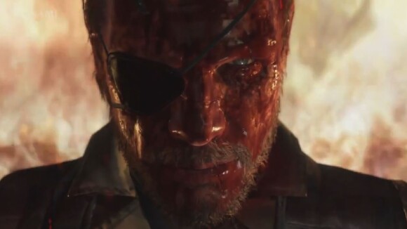 Metal Gear Solid 5 The Phantom Pain : le trailer fou et sanglant de l'E3 2014