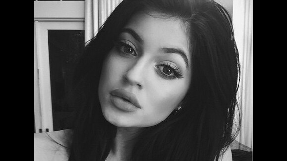 Kylie Jenner : ses lèvres gonflées par la chirurgie ? Elle répond enfin