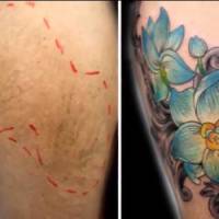 Des tatouages gratuits pour réparer les cicatrices de femmes battues : une idée brillante !
