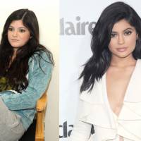 Kylie Jenner transformée : son chirurgien esthétique balance sur ses opérations des lèvres