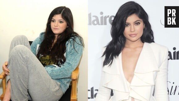 Kylie Jenner avant/après : en 2010 sans chirurgie esthétique à gauche et en 2016 après des opérations à droite.