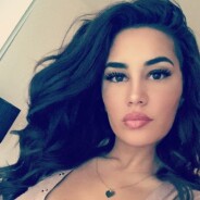 Milla Jasmine (Les Anges 8) le visage en sang sur Instagram : son secret beauté flippant