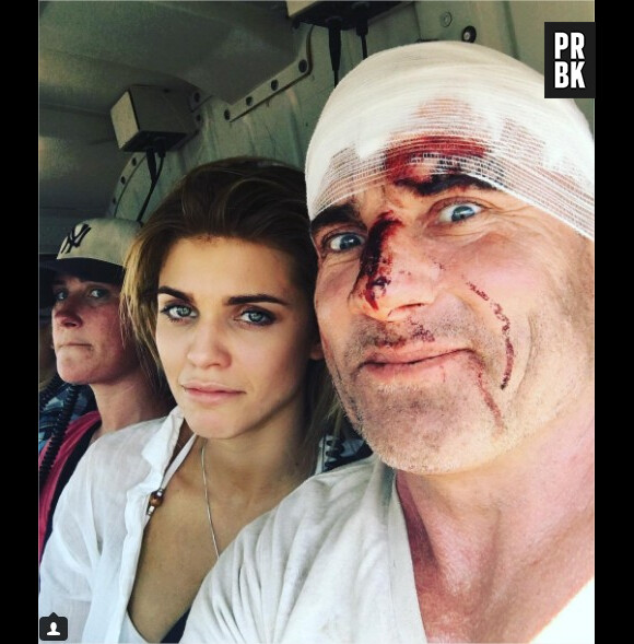 Dominic Purcell (Prison Break) : ses blessures intégrées à la saison 5