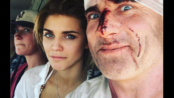 Prison Break saison 5 : les blessures de Dominic Purcell intégrées à la série