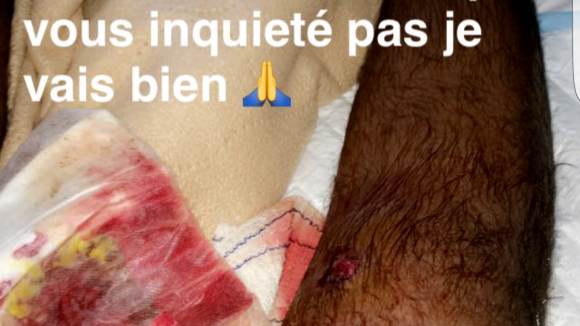 Sarah Fraisou : son ex Malik blessé par balle, il donne de ses nouvelles sur Snapchat