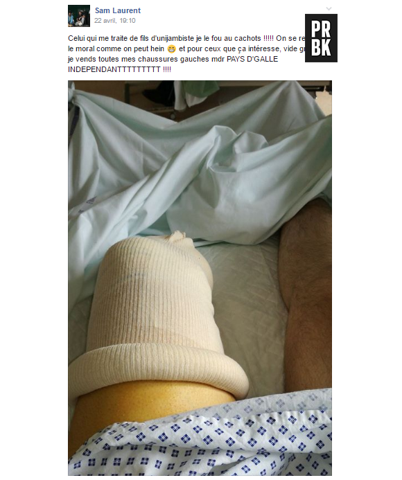 Kaamelott : un fan se fait amputer la jambe, Alexandre Astier prend de ses nouvelles