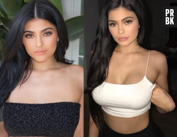 Kylie Jenner avant-après : en 1 an, elle s'est transformée physiquement !