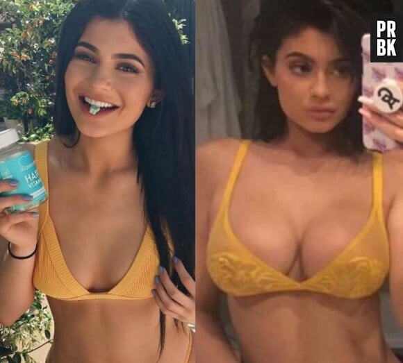 Kylie Jenner avant-après : en 1 an, elle s'est transformée physiquement !