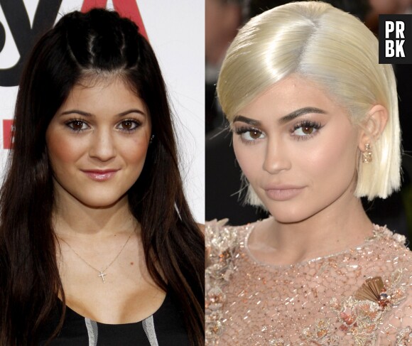Kylie Jenner en 2010 VS Kylie en 2017 : elle a énormément changé !