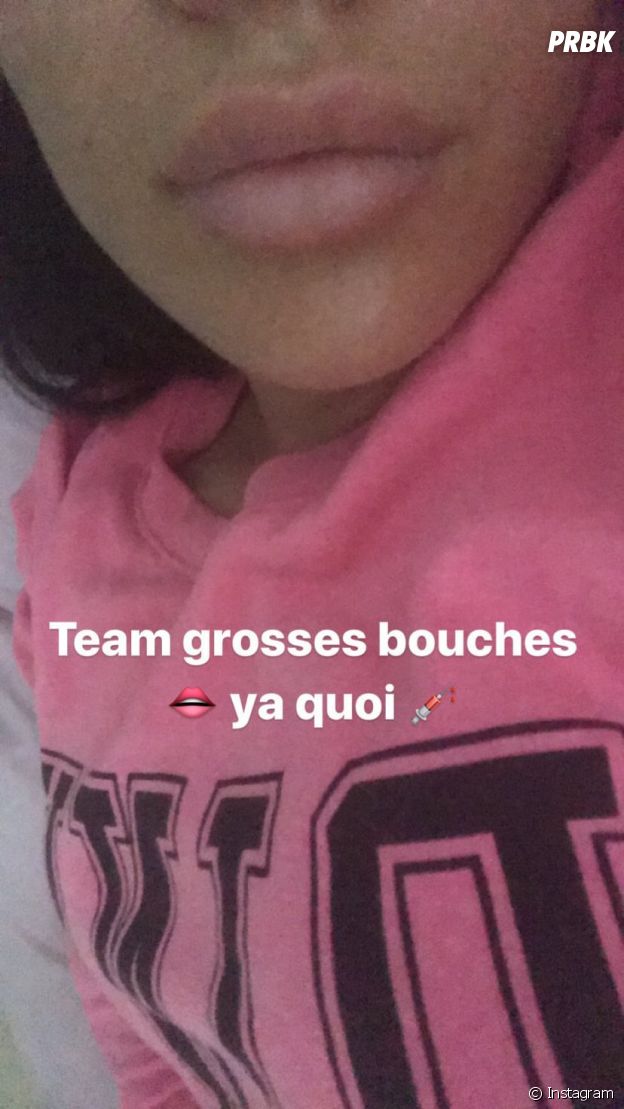 Milla Jasmine (Les Marseillais VS Le reste du monde) : ses lèvres XXL choquent, elle réplique