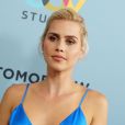 Claire Holt (The Vampire Diaries) annonce avoir été victime d'une fausse couche