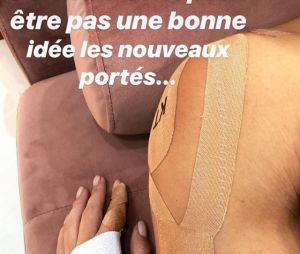 Danse avec les stars 9 : Iris Mittenaere et Anthony Colette blessés, ils dévoilent leurs blessures en photos sur Instagram.