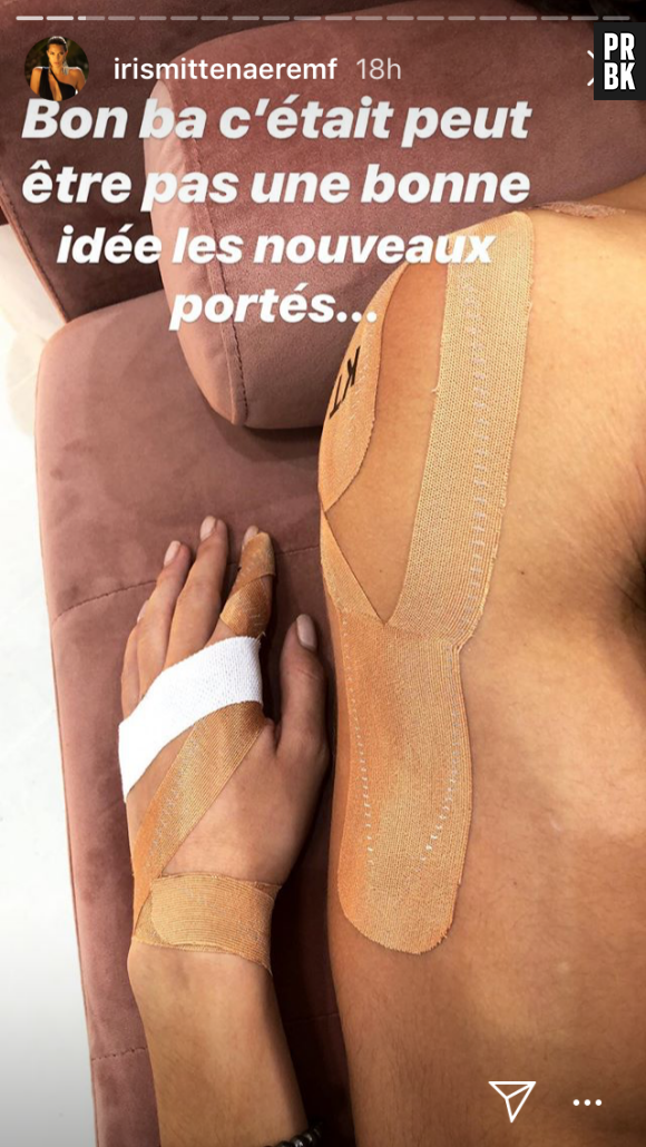 Danse avec les stars 9 : Iris Mittenaere et Anthony Colette blessés, ils dévoilent leurs blessures en photos sur Instagram.