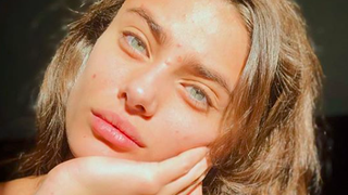 Taylor Hill : la top de Victoria's Secret assume ses boutons d'acné sur Instagram