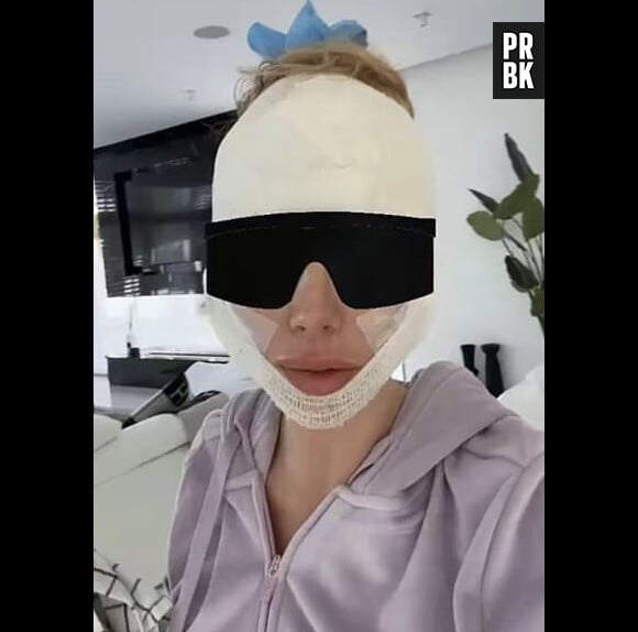 Jessica Thivenin s'affiche très gonflée après son opération au visage