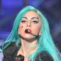 Lady Gaga et la barre de fer : elle affiche son bobo sur Twitter (PHOTO)