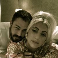 Lady Gaga : la guerre avec Madonna, l&#039;amour avec Taylor Kinney (PHOTO)
