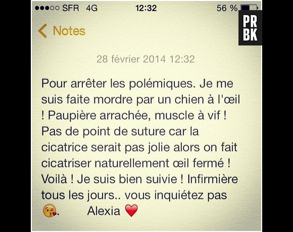 Alexia Mori (Secret Story 7) s'explique sur son pansement à l'oeil, le 28 février 2014 sur Instagram
