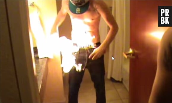 Le Fire Challenge : des jeunes adolescents s'immolent pour impressionner leurs amis sur Youtube