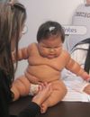 Bébé obèse : à 10 mois, Juanita Valentina Hernandez pèse 20 kilos, soit le poids d'un enfant normal de 5 ans