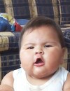 Bébé obèse : à 10 mois, Juanita Valentina Hernandez pèse 20 kilos, soit le poids d'un enfant normal de 5 ans