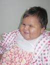 Bébé obèse : à 10 mois, Juanita Valentina Hernandez pèse 20 kilos, soit le poids d'un enfant normal de 5 ans