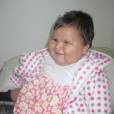 A 10 Mois Seulement Ce Bebe Obese Pese Le Poids D Un Enfant De Cinq Ans Purebreak