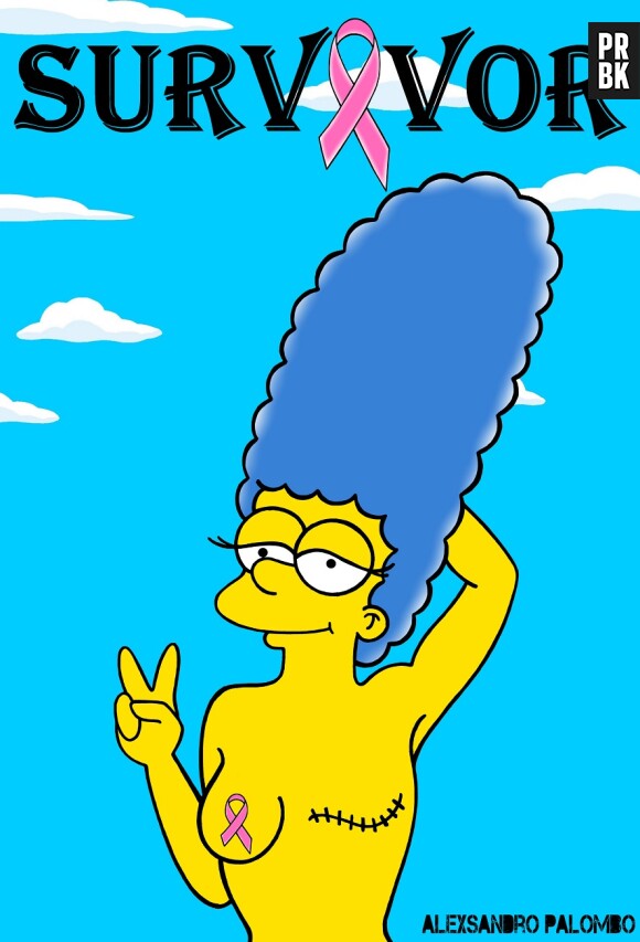 Marge Simpson avec les cicatrices d'une ablation mammaire, un détournement de l'artiste AleXsandro Palombo qui sensibilise le public au cancer du sein.
