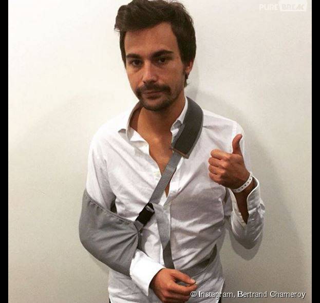 Bertrand Chameroy et son bras cassé sur Instagram