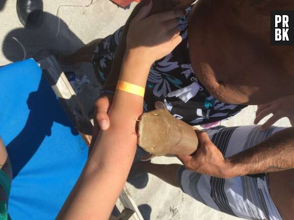Une femme mordue par un requin à Boca Raton, en Floride.