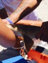 Une jeune femme blessée par un requin doit rester avec lui accroché au bras jusqu'à l'hôpital.