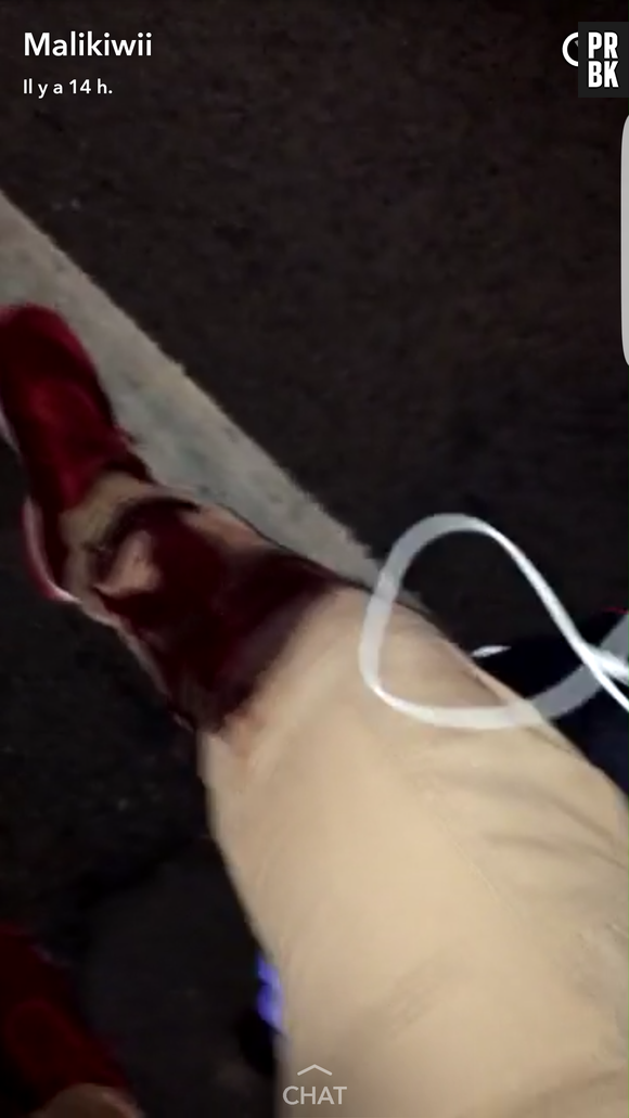 Sarah Fraisou : son ex Malik blessé par balle, les photos chocs sur Snapchat !