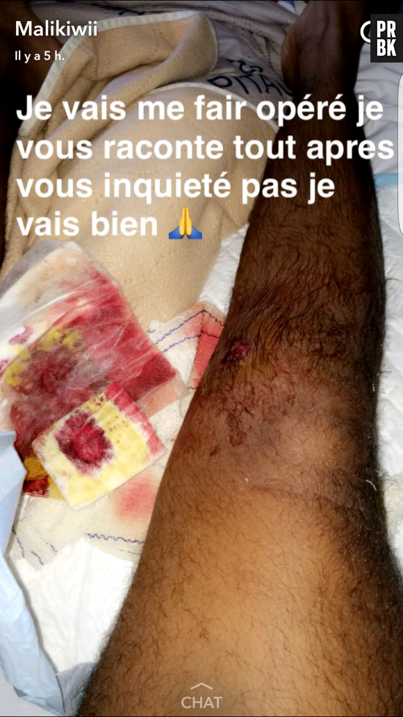 Sarah Fraisou : son ex Malik blessé par balle, les photos chocs sur Snapchat !
