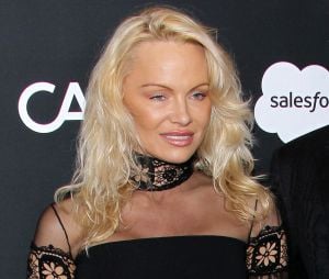 Pamela Anderson a-t-elle cédé à la chirurgie esthétique pour son visage ?