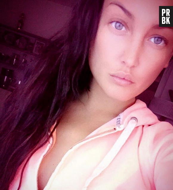 Aurélie Dotremont assume la chirurgie esthétique sur ses lèvres et pousse un coup de gueule sur Snapchat.